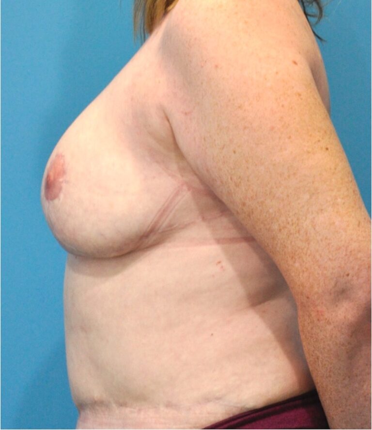 After Image